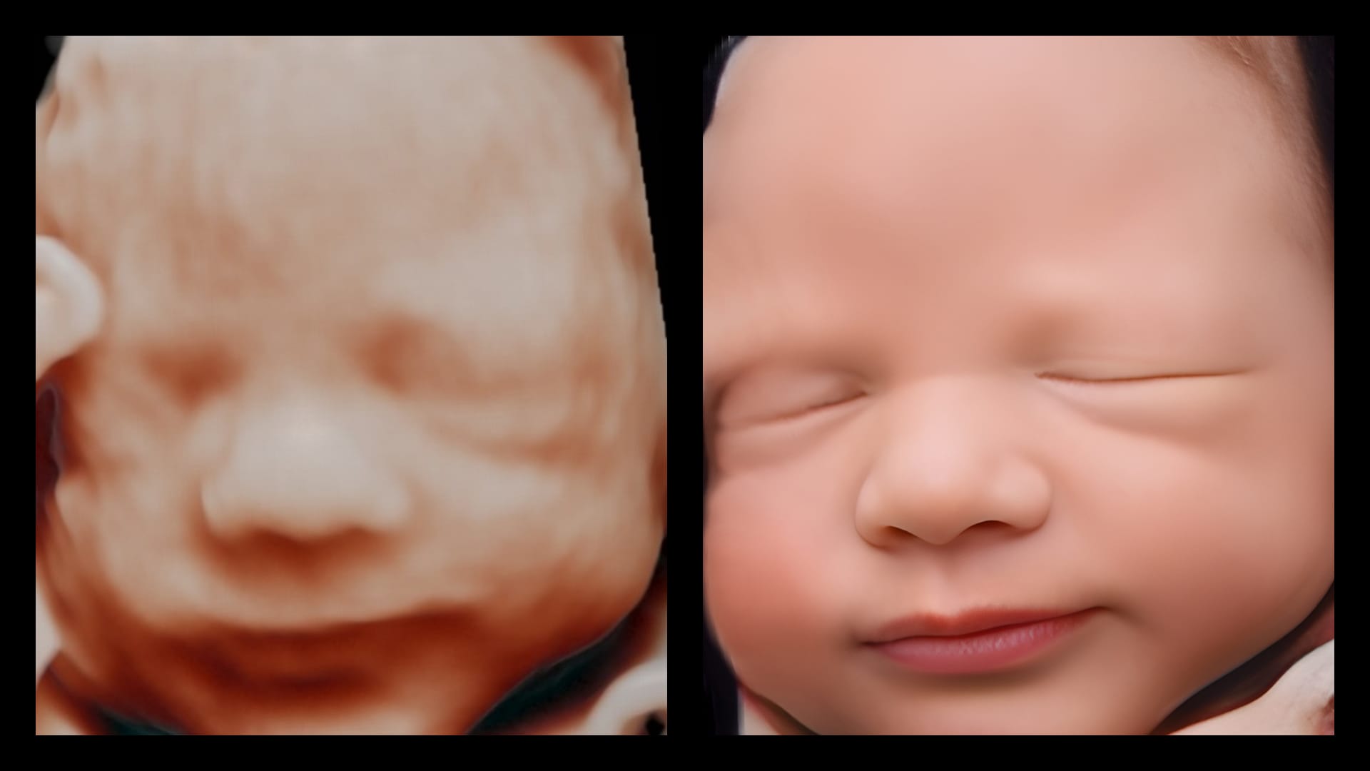 Ecografías 8k y el futuro de la obstetricia - BeÂ·ia